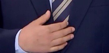 퉁퉁 부어버린 문재인의 손.jpg | 인스티즈
