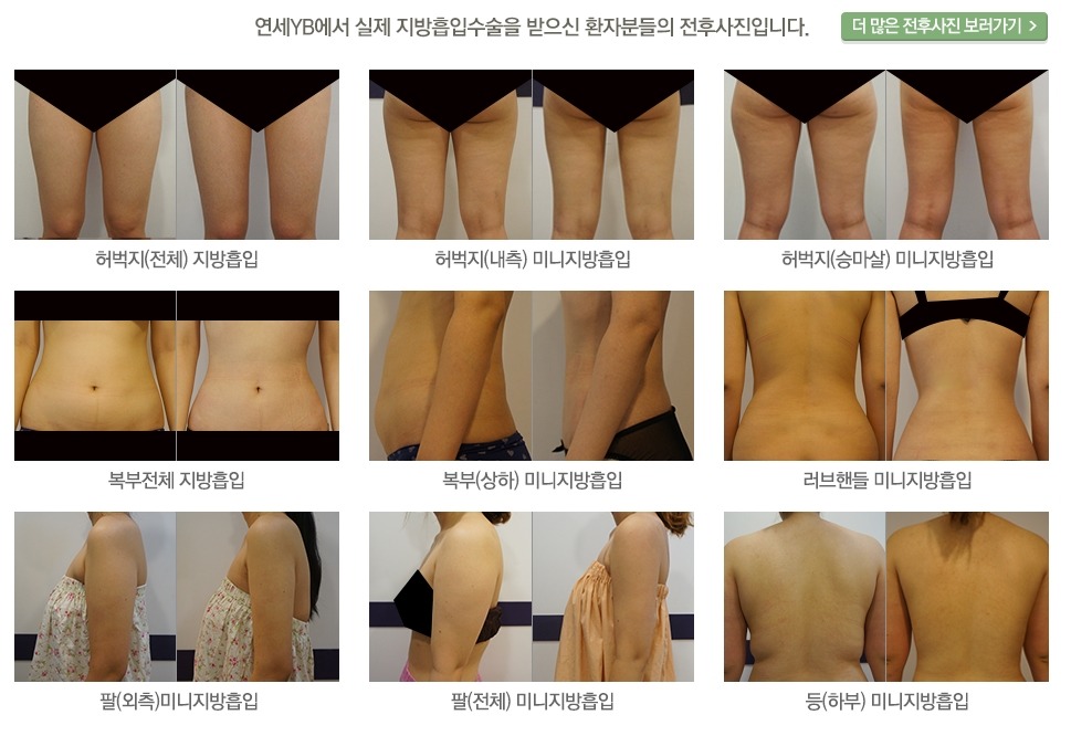 알와이비 이미지