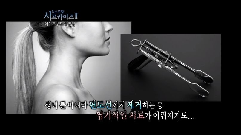 [서프라이즈] 잘못된 수술 레이크우드의 망령.jpg | 인스티즈