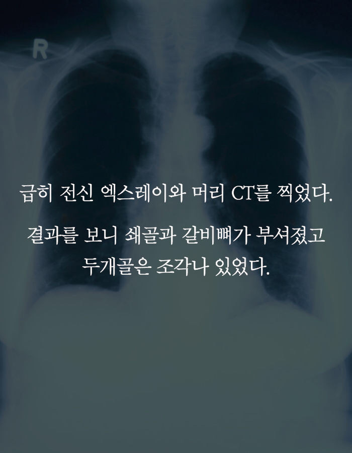 아동학대의 끔찍한 현실 | 인스티즈