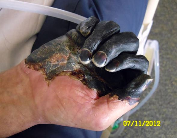 페스트가 전세계를 휩쓸었던 원인 중 하나 (혐오주의) | 인스티즈