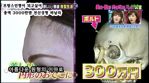 프랑스 인형이 되고싶어 총액 3000만엔 전신성형한 바닐라 | 인스티즈