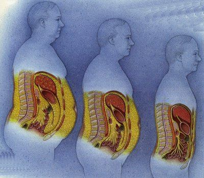 사람들마다 가지고 있는 뱃살 유형.jpg | 인스티즈